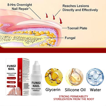 Restore Clear, Healthy Nails: Fast-Acting Antifungal Repair Solution